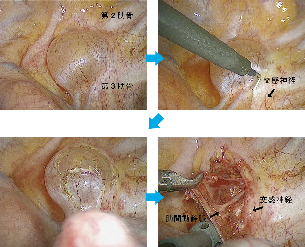 シリーズ呼吸器外科 2 縦隔腫瘍 胸壁腫瘍 中頭病院