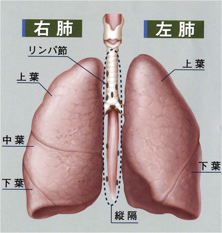 シリーズ呼吸器外科 4 肺がん 中頭病院