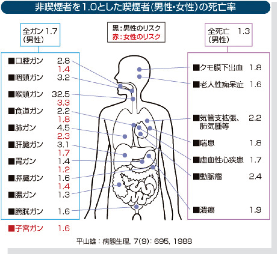 シリーズ呼吸器外科 4 肺がん 中頭病院